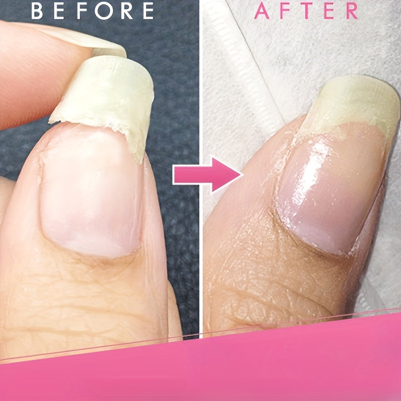 5 Pcs Instant Nail Gel - Protects Cracked Natural Nails - Nail Gel Kit For Emergencies