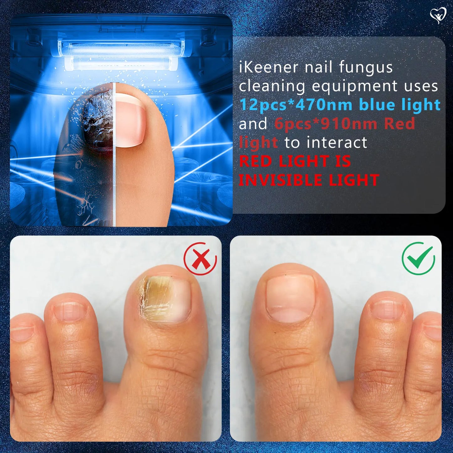 KTS Fungal Nail Laser Device Repair Fast Nails Fungus Onychomycosis Repair Toenail Fingernail Removes Nail Fungus Foot Care