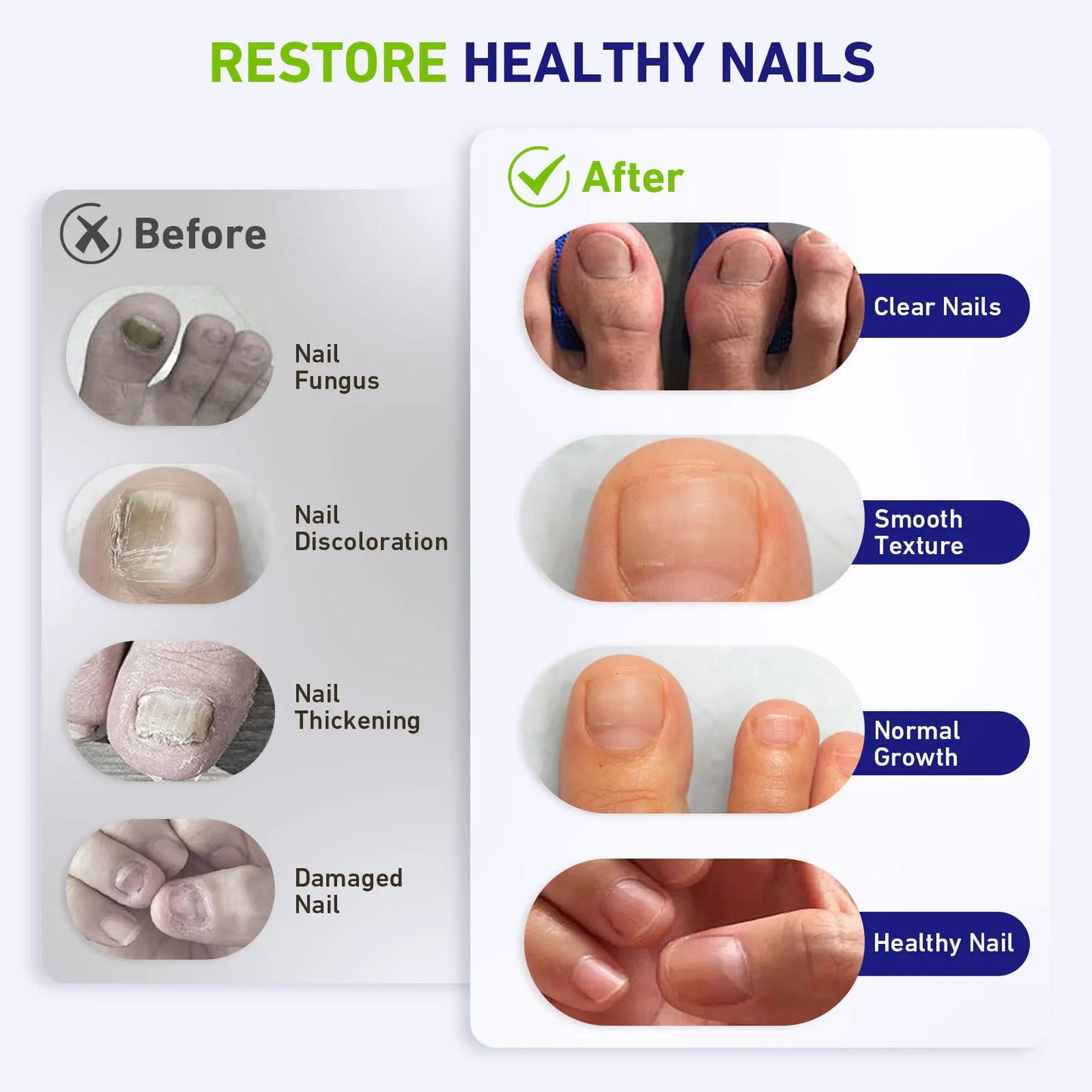 20W Nail Fungus Laser Therapy Device Intelligent Sensor&Digital Display 42pcs*650nm+15pcs*470nm Nail Fungus Remover Nail Care