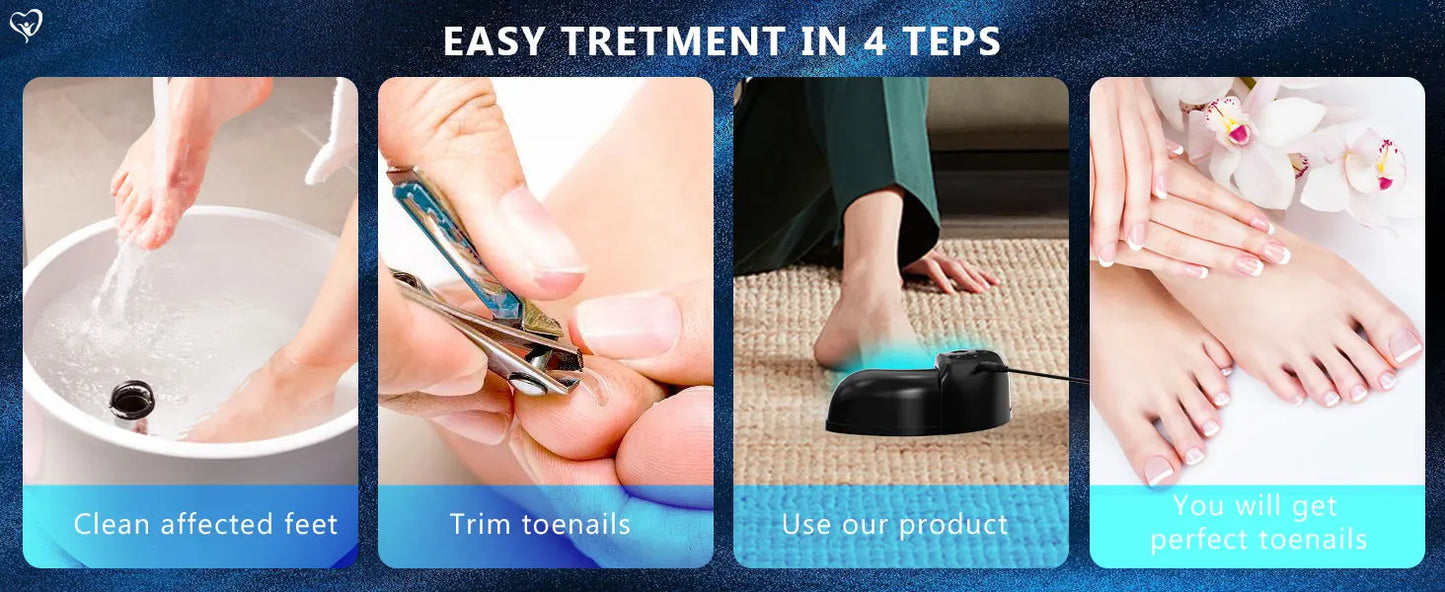 KTS Fungal Nail Laser Device Repair Fast Nails Fungus Onychomycosis Repair Toenail Fingernail Removes Nail Fungus Foot Care