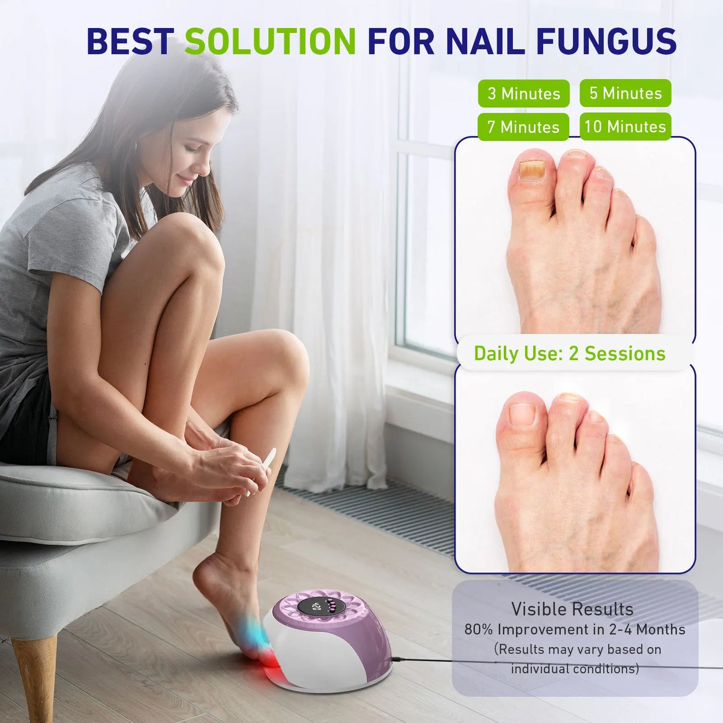 20W Nail Fungus Laser Therapy Device Intelligent Sensor&Digital Display 42pcs*650nm+15pcs*470nm Nail Fungus Remover Nail Care
